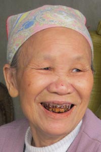 Chewing betel root spots one's teeth red.